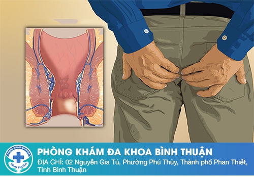 Đau hậu môn là bị gì? Có nguy hiểm không?