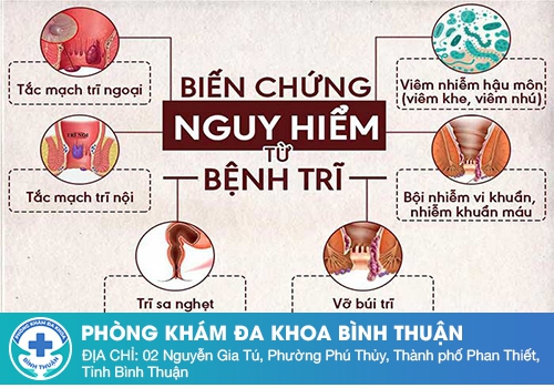 Bị trĩ sau sinh có nguy hiểm không?