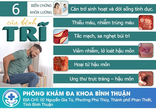 Bệnh trĩ đi phân ra máu tươi có nguy hiểm không?