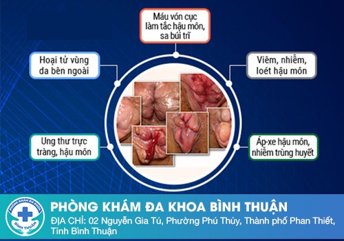 Triệu chứng đi cầu ra máu tươi nhiều có nguy hiểm không?