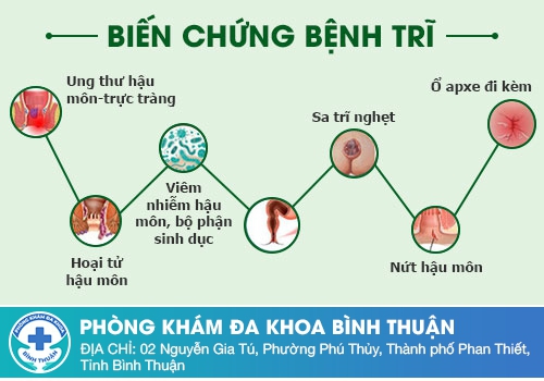 Bệnh trĩ ngoại gây ra có nguy hiểm không?