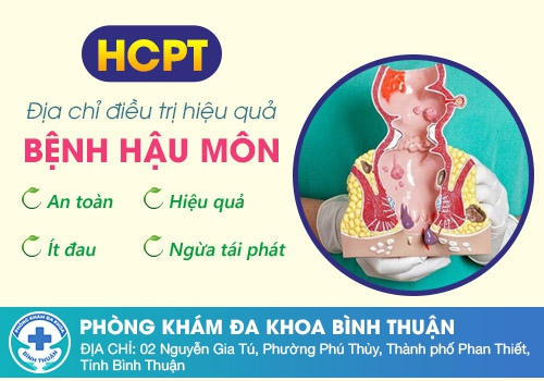 Địa chỉ điều trị bệnh trĩ uy tín tại Bình Thuận