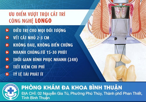 Cắt trĩ bằng phương pháp Logo, PPH