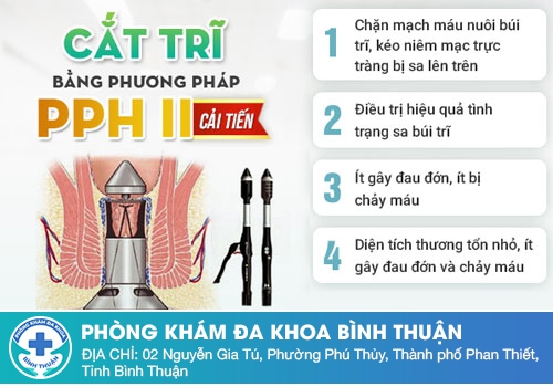  Phẫu thuật trĩ bằng phương pháp PPH-II