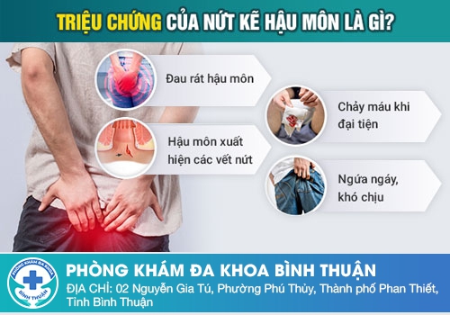 Nứt kẻ hậu môn có tự khỏi được không?