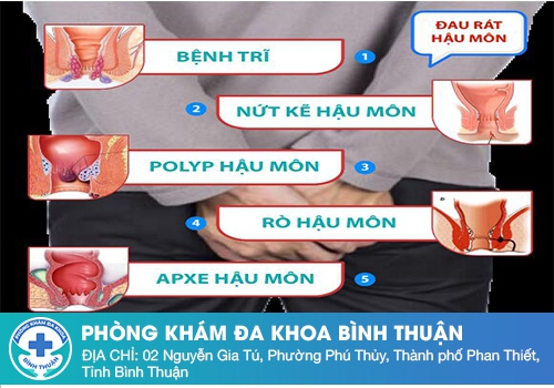 Đau rát hậu môn là bệnh gì?