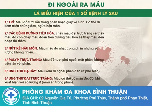 Nguyên nhân bị trĩ đi cầu ra máu là gì? 