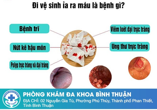 Đi phân ra máu tươi