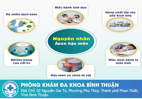 nguyên nhân gây bệnh áp xe