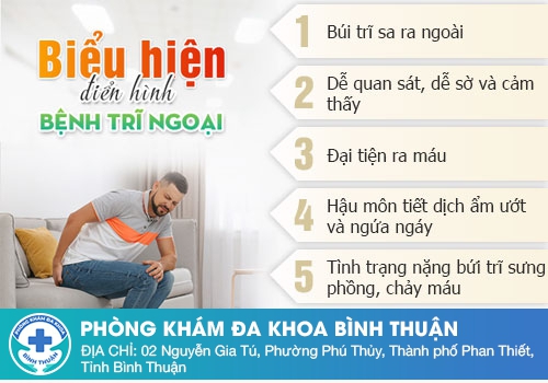 Đau tức hậu môn là bệnh gì – Bệnh trĩ ngoại