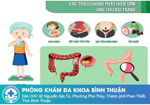 Đi cầu ra máu đỏ tươi do ung thư đại tràng