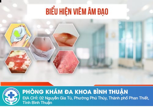 Mọc mụn nước âm đạo viêm phụ khoa