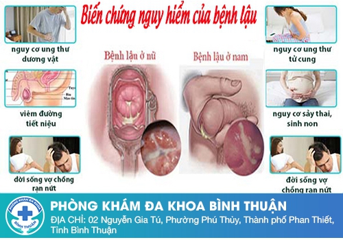 Tiểu buốt có mủ ở nam giới nguy hiểm như thế nào?