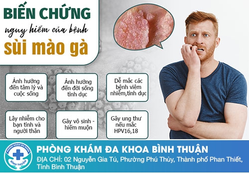 Biến chứng nguy hiểm của bệnh sùi mào gà ở nam giới