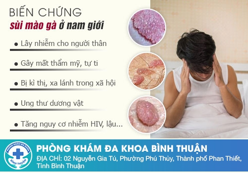 Sùi mào gà ở nam giới có nguy hiểm không?