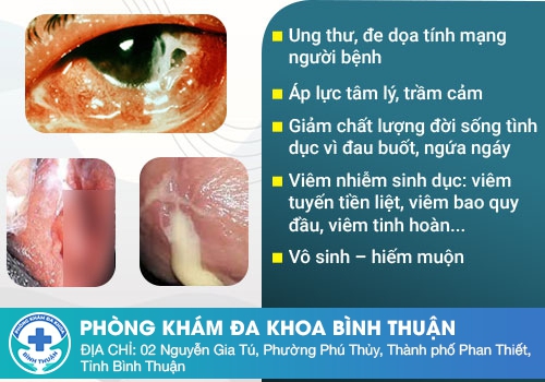 Bệnh lậu có nguy hiểm không?