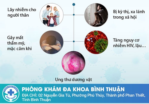 Sùi mào gà ở nam giới có nguy hiểm không?