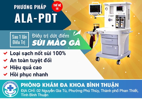 Cách chữa sùi mào gà ở miệng hiệu quả