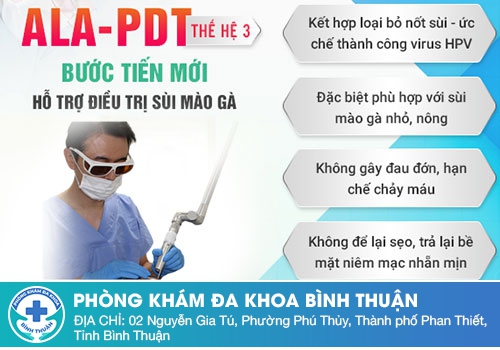 Điều trị sùi mào gà ở vùng kín bằng phương pháp tân tiến ALA – PDT hiệu quả cao