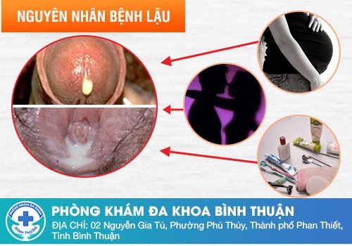 Bệnh lậu có lây không?