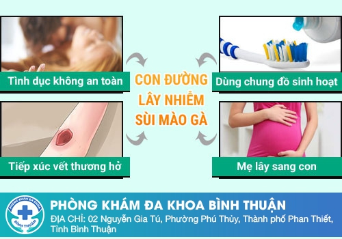 Nguyên nhân gây bệnh sùi mào gà ở nam giới