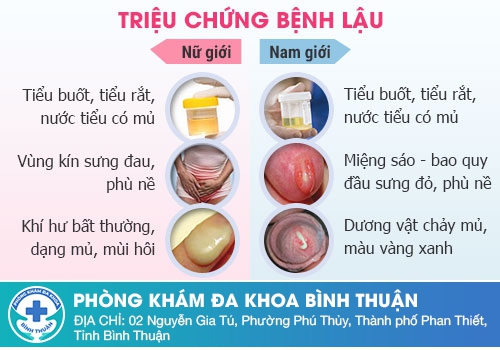 Tiểu buốt ra mủ là gì?