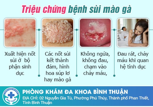 Biểu hiện sùi mào gà ở nam giới