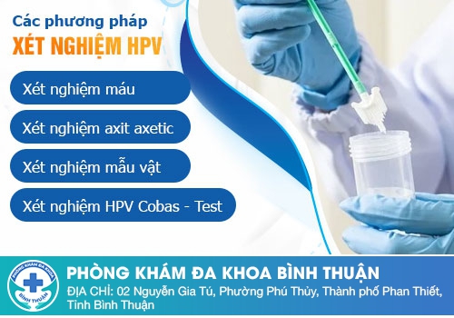 Xét nghiệm sùi mào gà ở đâu uy tín