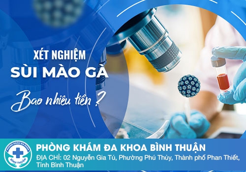 Xét nghiệm sùi mào gà bao nhiêu tiền?