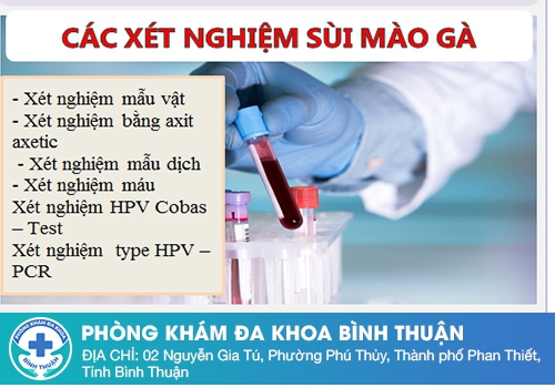 Các phương pháp xét nghiệm sùi mào gà chính xác hiện nay