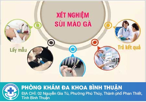 Quy trình xét nghiệm sùi mào gà