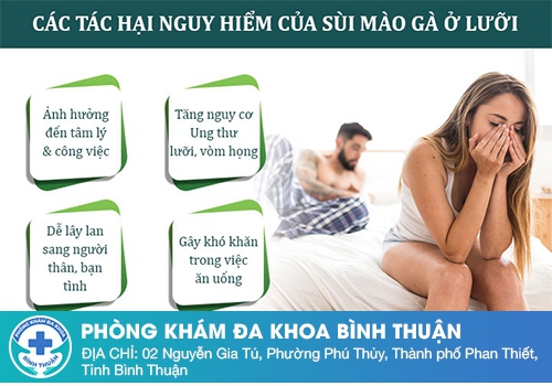 Sùi mào gà ở lưỡi có gây nguy hiểm không?