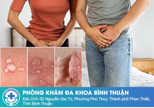 Nổi mụn âm đạo – Dấu hiệu cảnh báo nhiều bệnh lý nguy hiểm