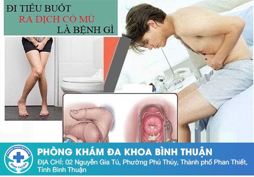 Nguyên nhân gây ra tình trạng tiểu buốt có mủ ở nam giới