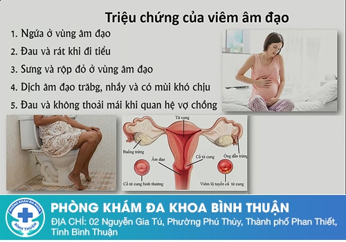 Nổi thịt thừa cửa mình do bệnh viêm âm đạo