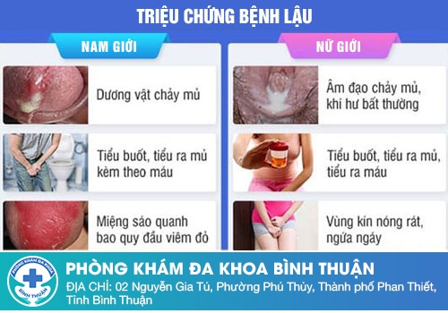 Đi tiểu buốt có mủ ở nam giới là bệnh gì?