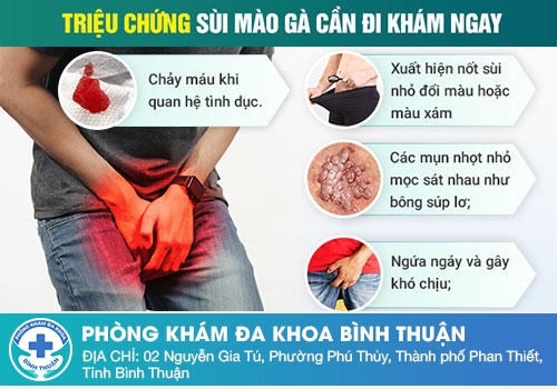 Dấu hiệu bệnh sùi mào gà ở nam giới