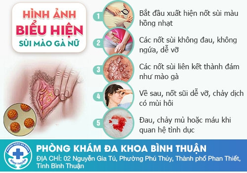 Cục thịt thừa âm đạo là bệnh gì? – Bệnh sùi mào gà