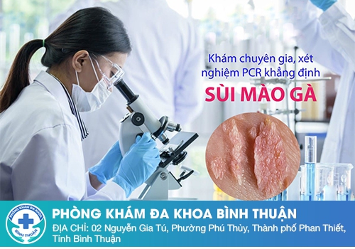 Chi phí khám sùi mào gà bao nhiêu tiền?