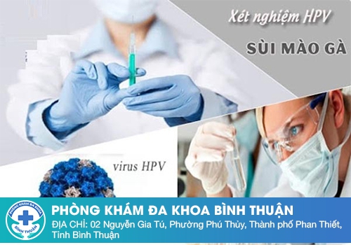 Xét nghiệm sùi mào gà bằng cách nào chính xác nhất?