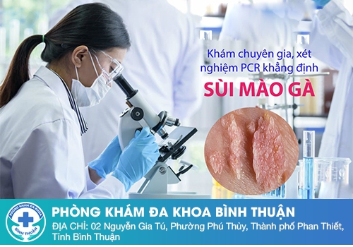 Xét nghiệm sùi mào gà bao nhiêu tiền?