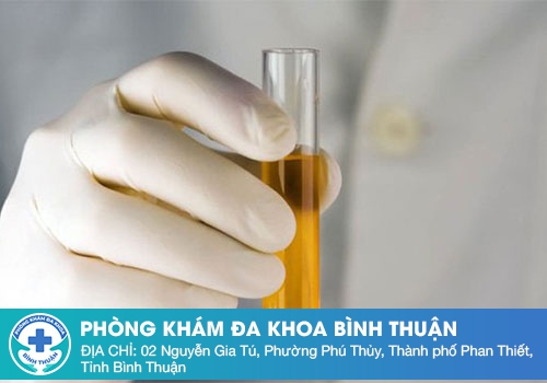 Cách lấy nước tiểu đúng cách để thực hiện xét nghiệm