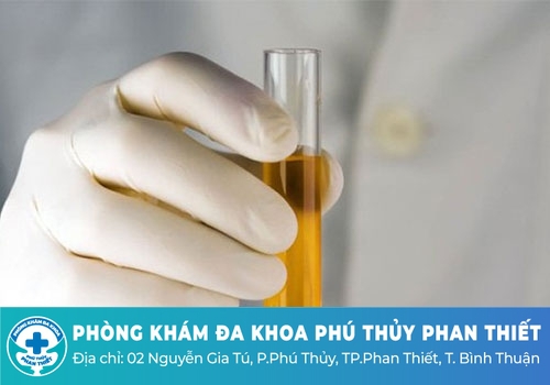 Cách lấy nước tiểu đúng cách để thực hiện xét nghiệm Cách lấy nước tiểu đúng cách để thực hiện xét nghiệm