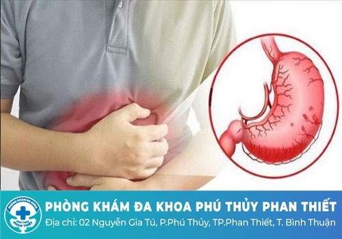 Thói quen uống nước sau đây không ngờ có thể gây hại cho sức khỏe Thói quen uống nước sau đây không ngờ có thể gây hại cho sức khỏe