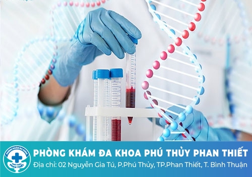 Xét nghiệm tổng quát máu cần lưu ý những gì? Xét nghiệm tổng quát máu cần lưu ý những gì?