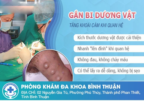 Nên gắn bi ở đâu để đảm bảo an toàn và hiệu quả