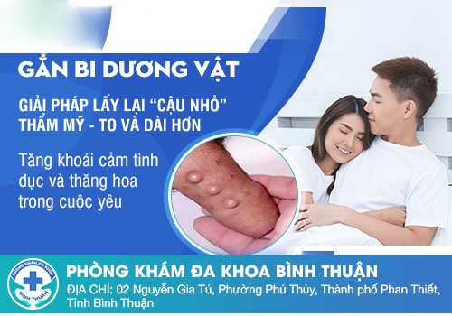 Những lưu ý khi gắn bi dương vật là gì?