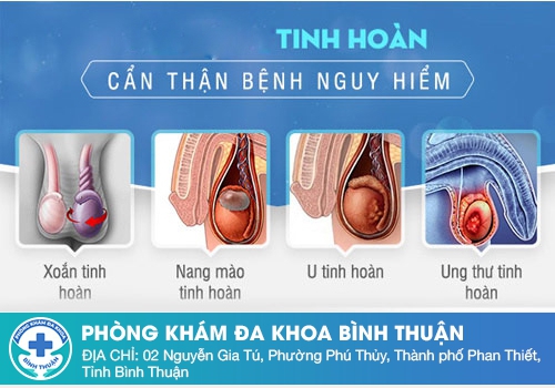 Các bệnh về tinh hoàn