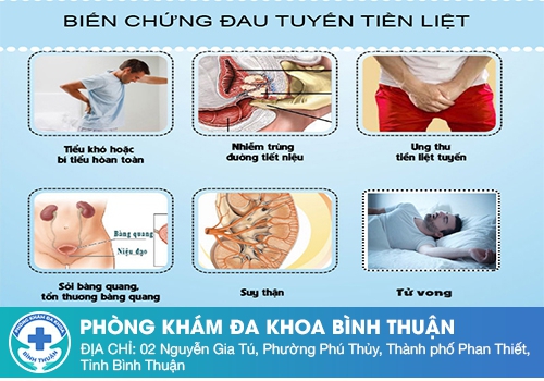 Tác hại của viêm tuyến tiền liệt với sức khỏe