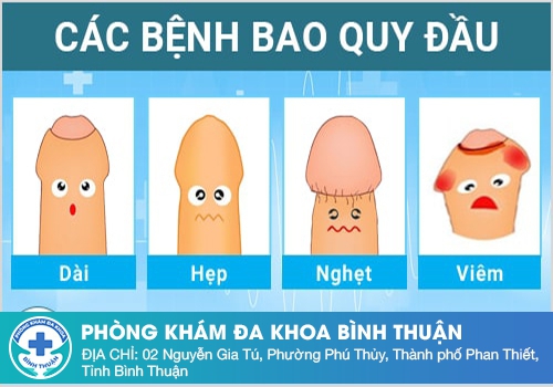 Những bệnh bao quy đầu thường gặp ở nam giới